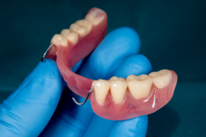 What’s Better A Dental Implant Or A Partial Denture