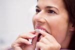 a girl is putting invisalign on her teeth