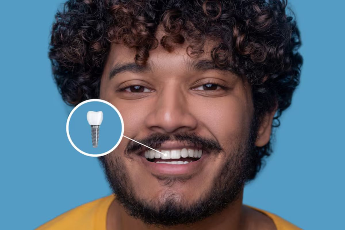 a man is smiling and showing the perfect dental bridge
