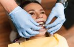 how invisalign works for adults in south edmonton