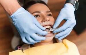 how invisalign works for adults in south edmonton