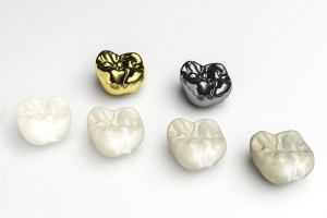 What is Dental Crowns